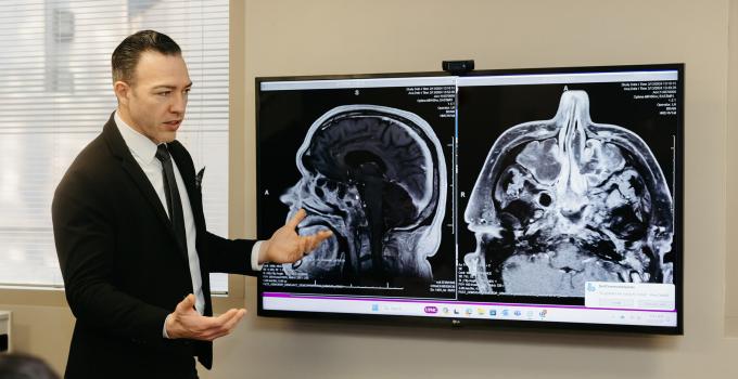 Cranial Base Research