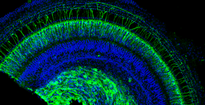 Spiral Cochlea